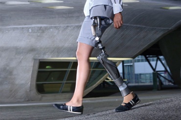 iglidur yataklı Otto Bock HealthCare GmbH kalça eklemi protezi